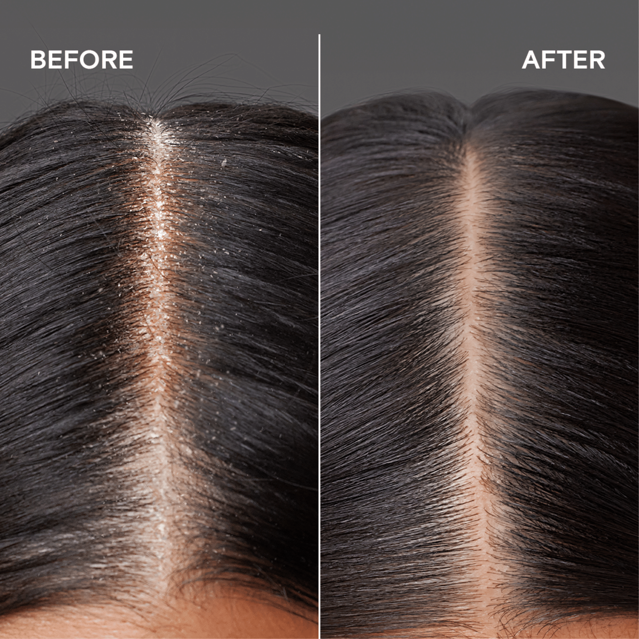 Joico Scalp Vitality  Refreshing Shampoo 300ml
