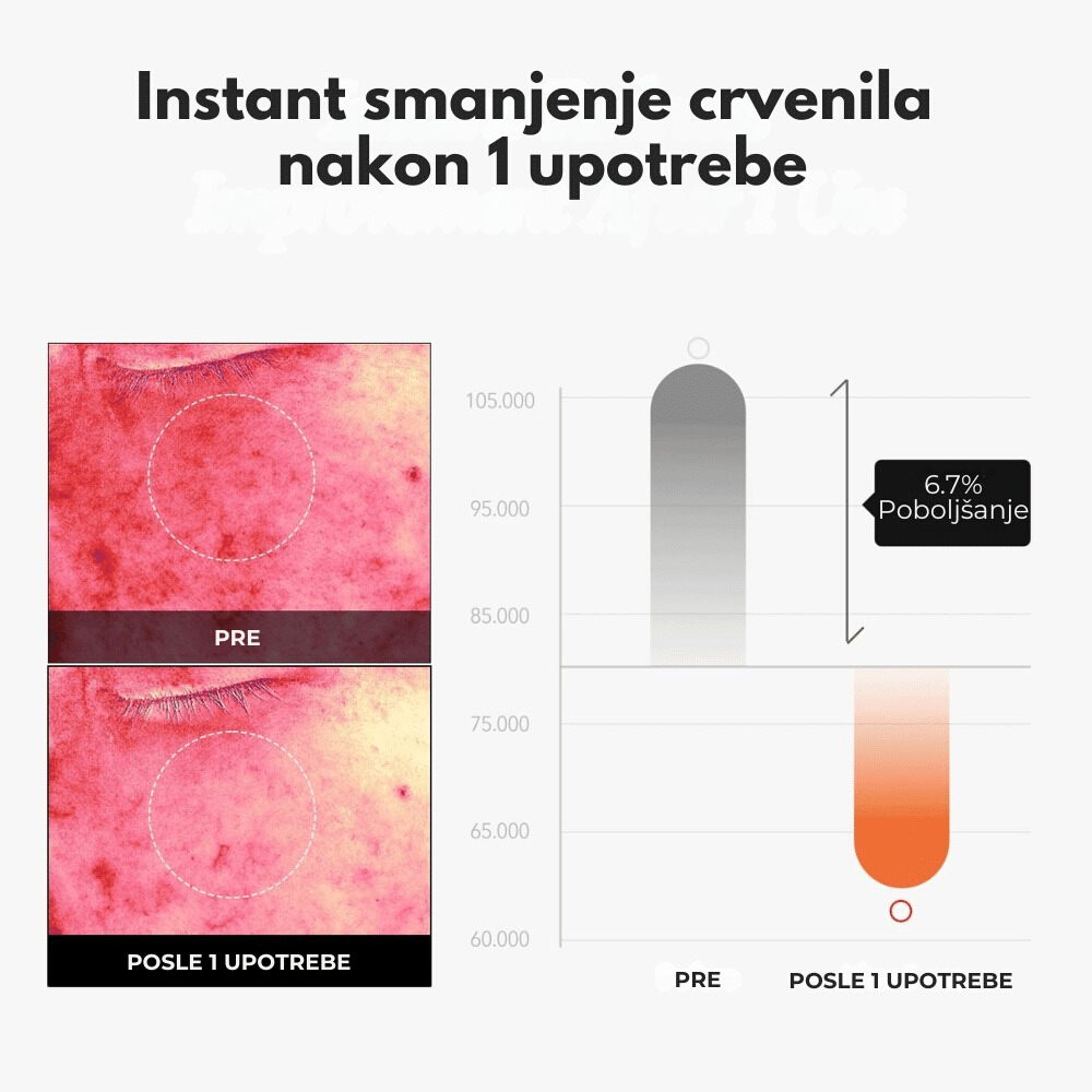 Carrotene IPMP Instant Calming Serum Pads 80 pads