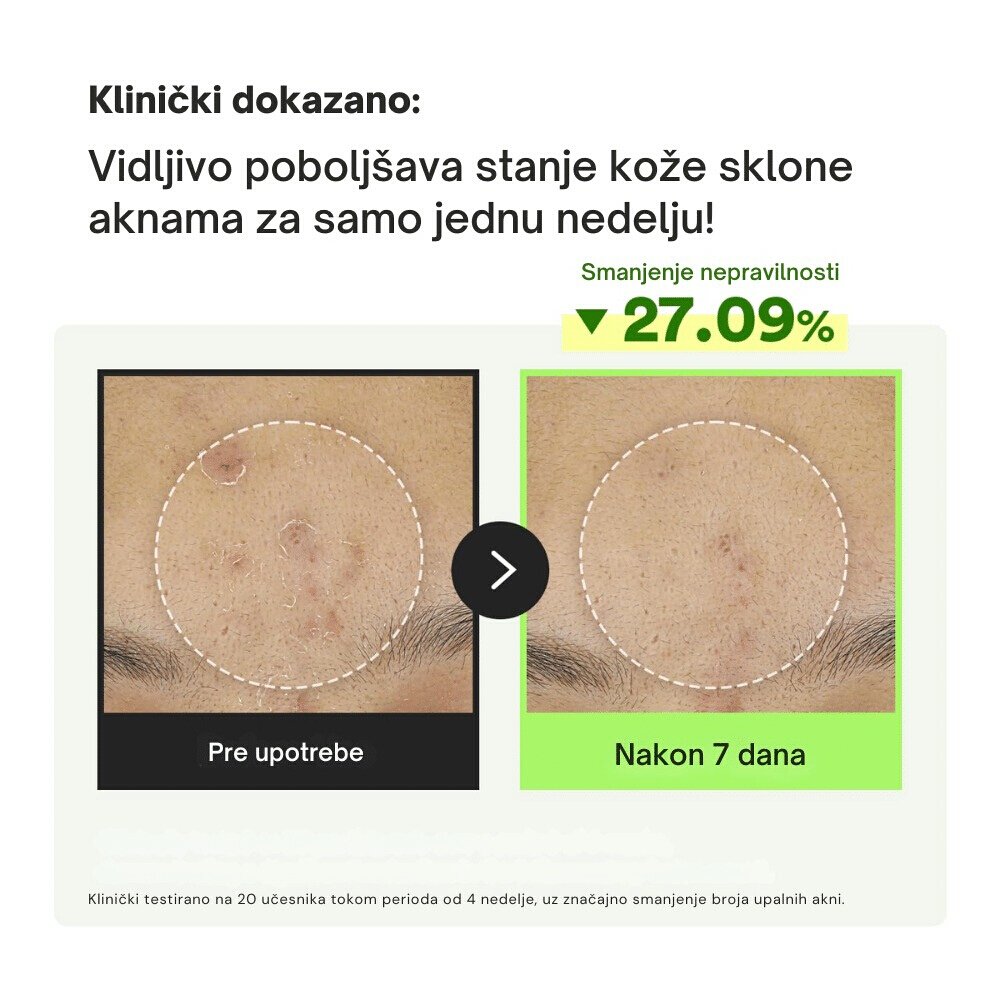 Heartleaf Teca Capsule Serum Calming Drop 50ml