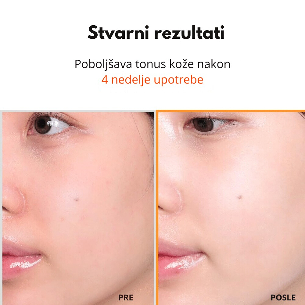 Hyper Vitamin C 23 Serum 20ml