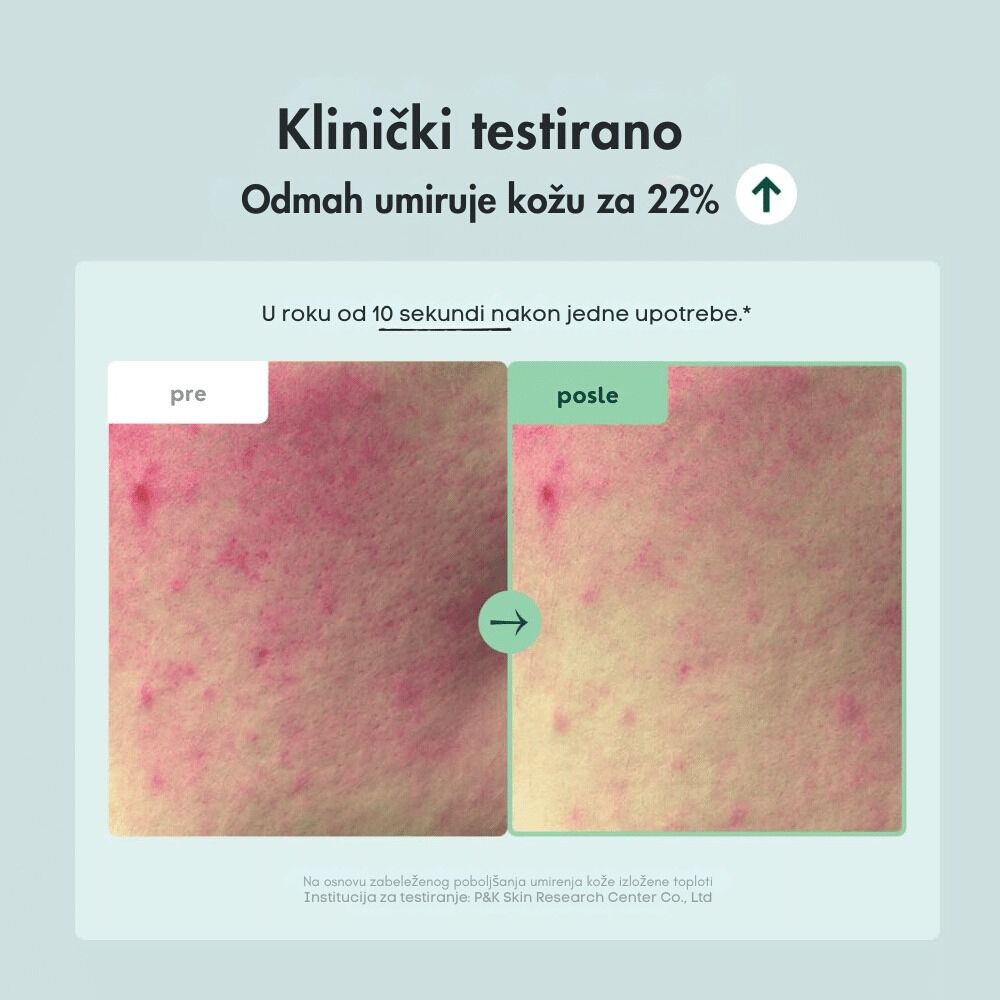 Wonder Releaf Centella Eye Cream 30ml